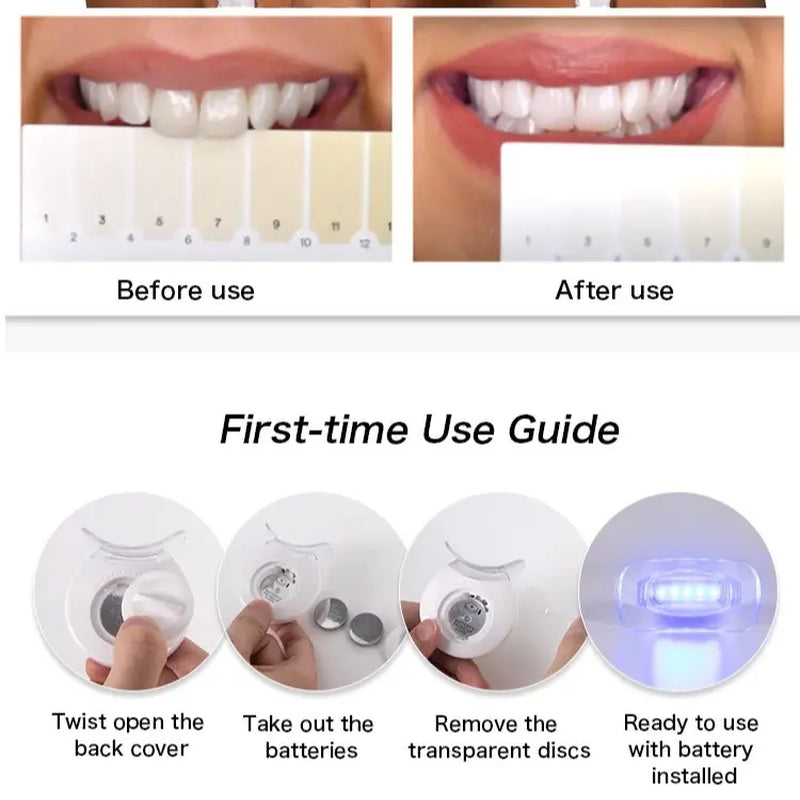 InstantComfort™ Oral Teeth Whitening Kits 